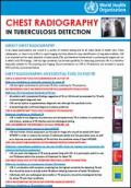 Chest Radiography in Tuberculosis Detection